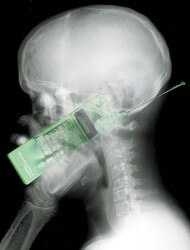 Anyone who thinks this is a good idea should have their head examined