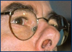 We hope Congressman Waxman feels a lot better than he looks